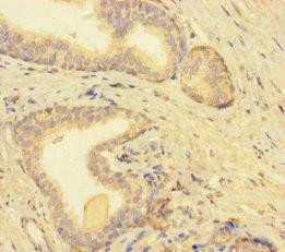 TMEM52B Antibody (PACO36074)