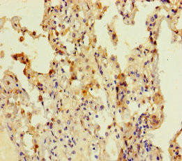 CCDC184 Antibody (PACO36086)
