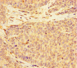 C2CD6 Antibody (PACO36098)