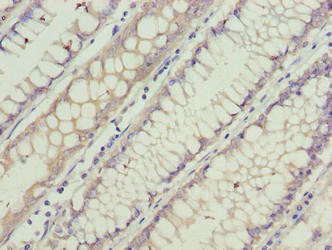 GCSAML Antibody (PACO36182)