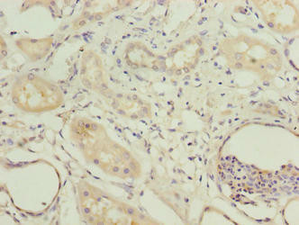 COBLL1 Antibody (PACO36250)