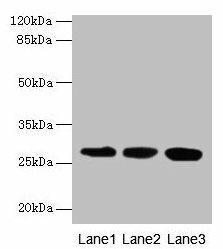 KHDC1 Antibody (PACO36282)