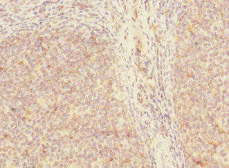 SH3D19 Antibody (PACO36294)