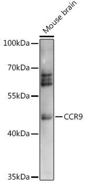 Anti-CCR9 Antibody (CAB14848)