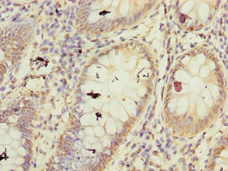 FBXW10 Antibody (PACO36506)