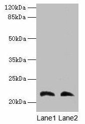 LGALS9C Antibody (PACO36526)