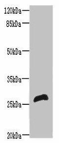 RTP2 Antibody (PACO36530)