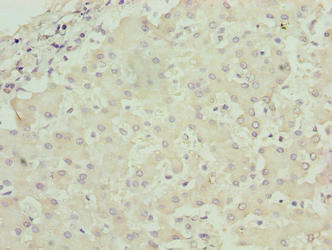 RPL7L1 Antibody (PACO36638)