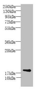 MORN5 Antibody (PACO36662)