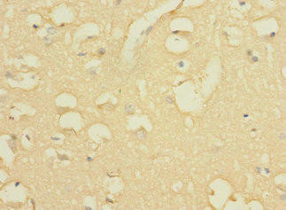 GALNT17 Antibody (PACO36746)