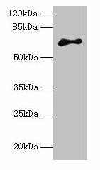 ARMCX2 Antibody (PACO36998)
