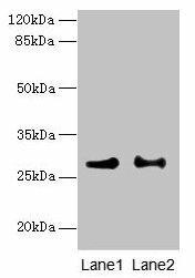 HACD2 Antibody (PACO37102)