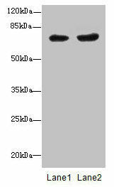 PGM2L1 Antibody (PACO37150)