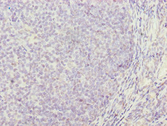 TRAT1 Antibody (PACO37162)