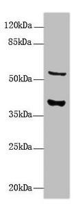 CALHM3 Antibody (PACO37250)