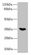 LYSMD3 Antibody (PACO37270)