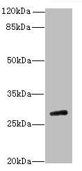 TBC1D26 Antibody (PACO37298)