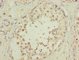 OOSP2 Antibody (PACO37310)