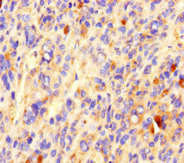 CCDC84 Antibody (PACO37366)