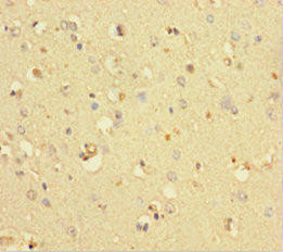 COMMD6 Antibody (PACO37382)