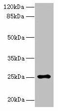 ARPIN Antibody (PACO37454)