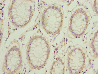 COMMD2 Antibody (PACO37474)