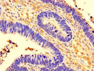 CCDC91 Antibody (PACO37550)