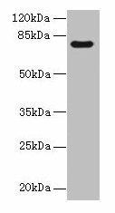 TTC30A Antibody (PACO37566)