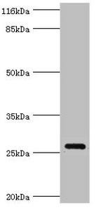 OFCC1 Antibody (PACO37642)