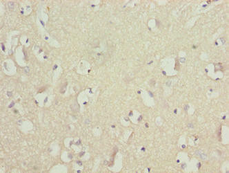 GLB1L2 Antibody (PACO37702)