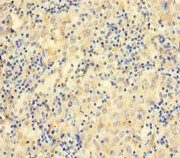 CCDC36 Antibody (PACO37842)