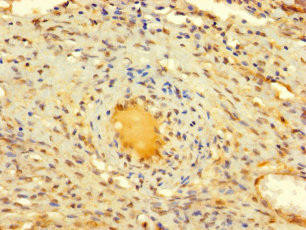 DIS3L2 Antibody (PACO37886)