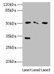 SLC38A6 Antibody (PACO37902)