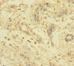 VKORC1L1 Antibody (PACO37906)