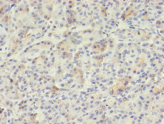 VWA5B2 Antibody (PACO37922)