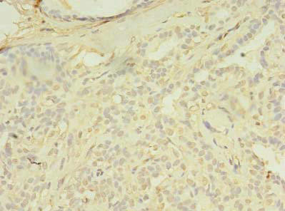 SPIC Antibody (PACO37934)