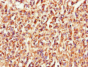 LSMEM1 Antibody (PACO37954)