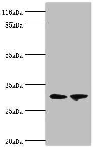 ACBD4 Antibody (PACO37966)