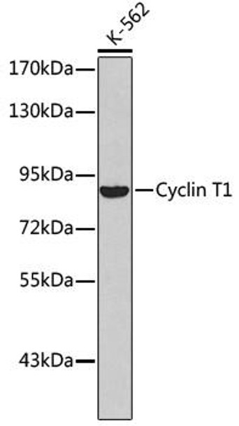 Anti-Cyclin T1 Antibody (CAB2057)