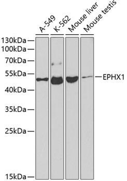 Anti-EPHX1 Antibody (CAB2070)