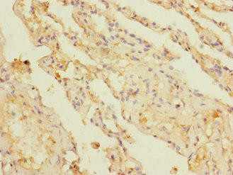 KCTD6 Antibody (PACO38314)