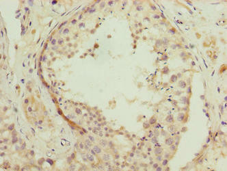 NSUN7 Antibody (PACO38322)