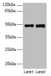 DBF4B Antibody (PACO38330)