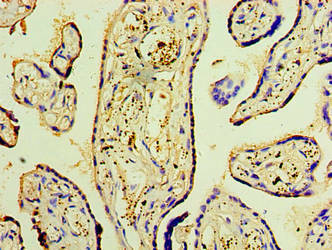 DNAH3 Antibody (PACO38346)