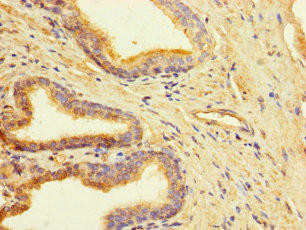 CLUAP1 Antibody (PACO38414)
