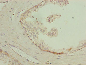 LYSMD1 Antibody (PACO38506)