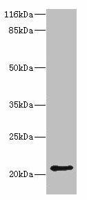 HDDC3 Antibody (PACO38538)