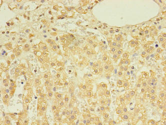 DHRSX Antibody (PACO38542)