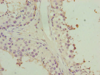 HORMAD2 Antibody (PACO38550)