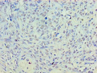 PLD5 Antibody (PACO38554)